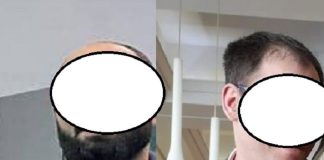 Medici de la Spitalul Spiridon testați pentru droguri înainte de intrarea în gardă. Anchetă la DIICOT