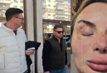 Foto/Video! Urmele unor violențe de nedescris. Logodnica polițistului SAS cere ordin de protecție Răzvan Moldovanu și loviturile la față ale victimei