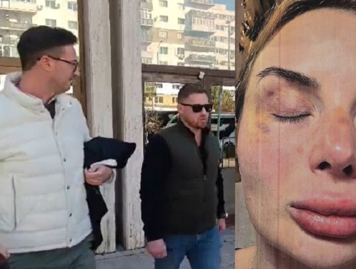 Răzvan Moldovanu și loviturile la față ale victimei