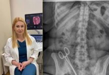 Caz șocant de malpraxis la Spitalul Arcadia. Pacienta a fost operată de urgență, după ce medicul i-a uitat o pensă chirurgicală în abdomen